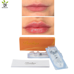 Bouliga Dermal filler 2ml 100% hyaluronzuur 20mg/ml concentratie voor Lip Glow Up